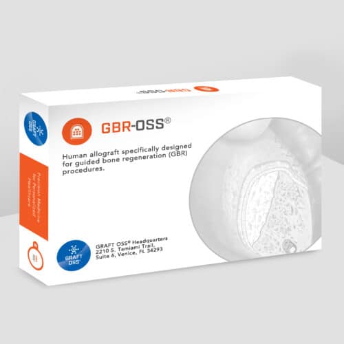 GBR-Oss
